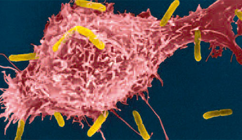 Unitat 8-Immunologia